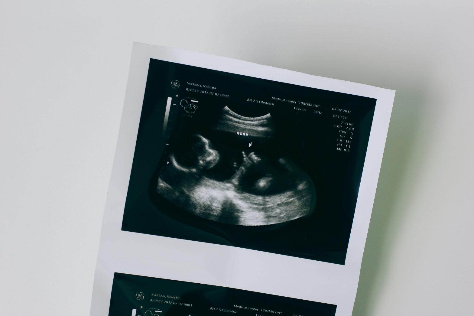 An Integrative Approach to Fertility Optimization